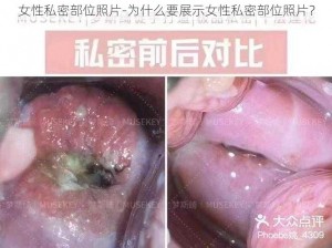 女性私密部位照片-为什么要展示女性私密部位照片？