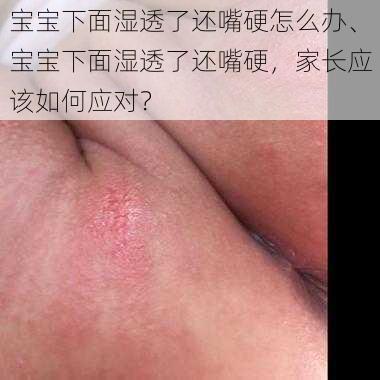 宝宝下面湿透了还嘴硬怎么办、宝宝下面湿透了还嘴硬，家长应该如何应对？